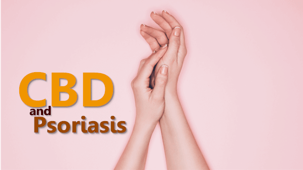 cbd psoriasis